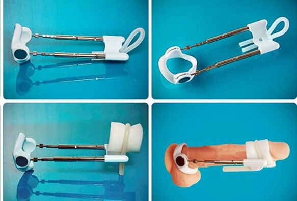 Extensor para engrosar el pene