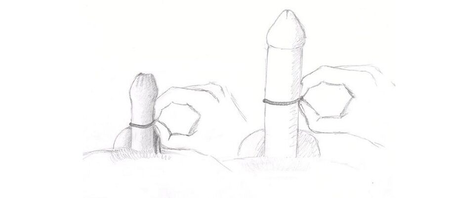 Medir el grosor del pene
